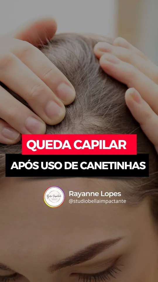Capa do reel sobre queda capilar após o uso de canetinhas para emagrecer